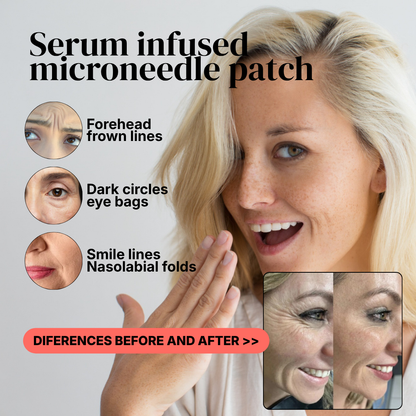 MicroLift™ Under-Eye Patches by ALECARE | Instant Lift. Lasting Youth.